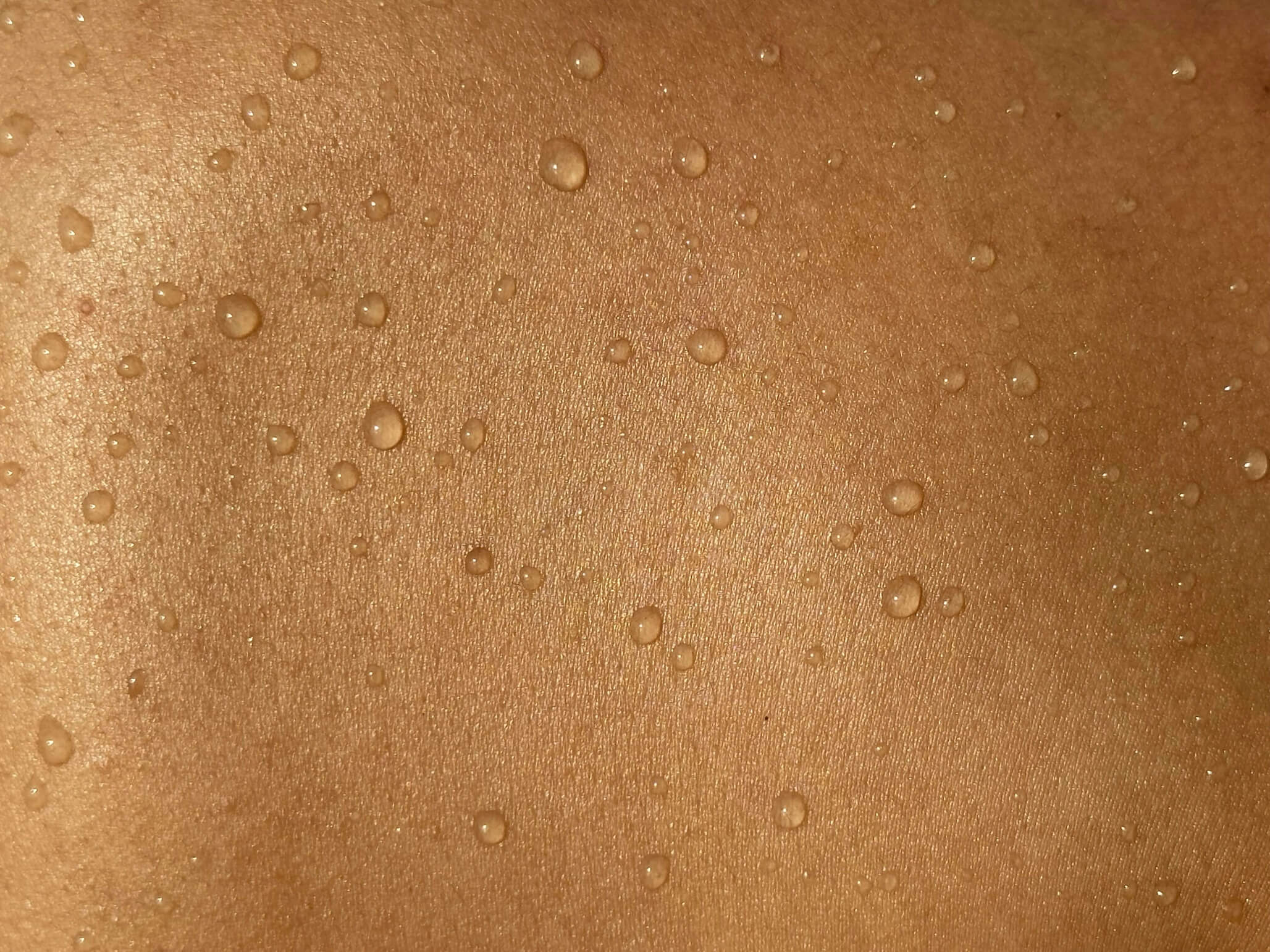 Behandlung von Hyperhidrose Kleine Wassertröpfchen auf einer schönen Haut