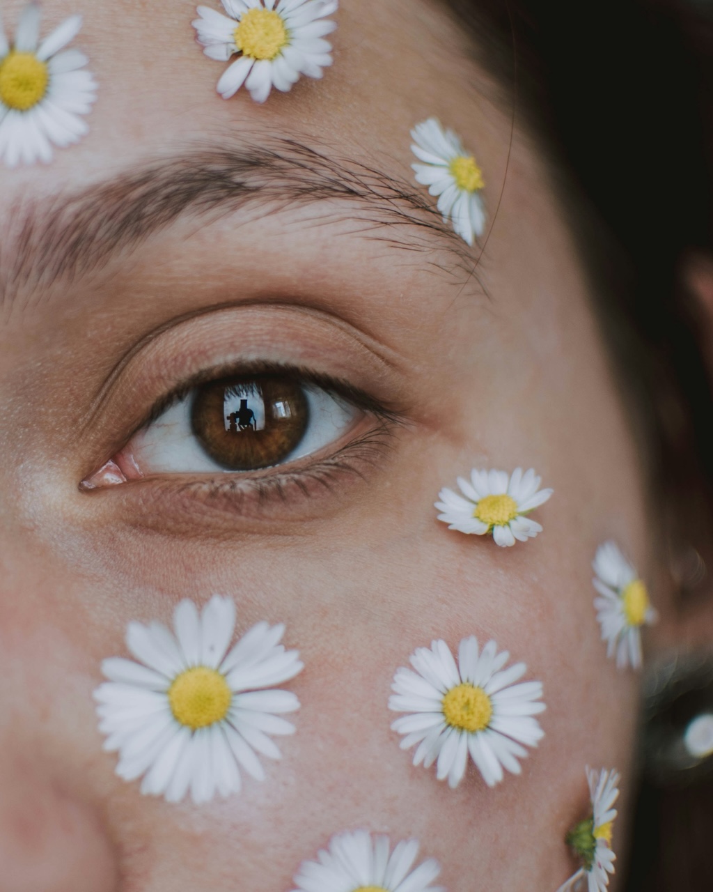 Eigenbluttherapie (PRP) Behandlung Nahaufnahme eines Auges mit Gänseblümchen auf der Haut